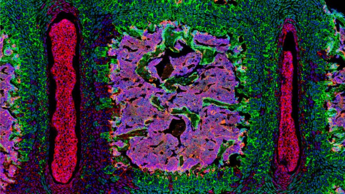 Os cientistas descobriram um novo tipo de célula-tronco que forma o tecido espinhal (em camundongos, essas células-tronco e as células que elas produzem são mostradas em verde). J. SUN ET AL./NATUREZA 2023