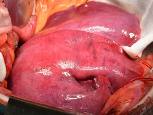 Uma visão ampliada do fígado de porco durante o procedimento de xenotransplante. Crédito: Hospital Xijing, Universidade Médica da Força Aérea em Xi'an, China.
